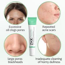 Crème anti-acné à l'acide salicVAC