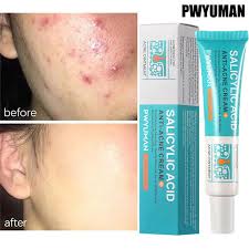 Crème anti-acné à l'acide salicVAC